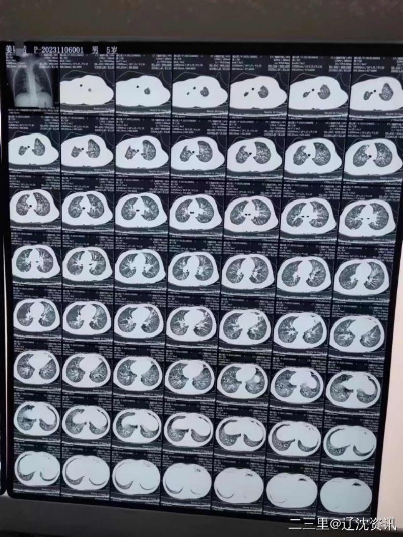 y80000��������